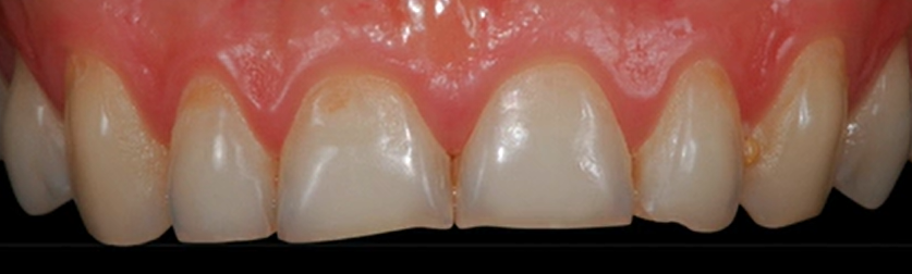 The Esthetic Connection: Smile Design Communication | Dr Galip Gurel