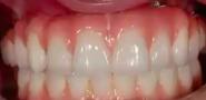 A-Z in Restorative Implant Dentistry (Part 7b) - Technical Requirements for Var