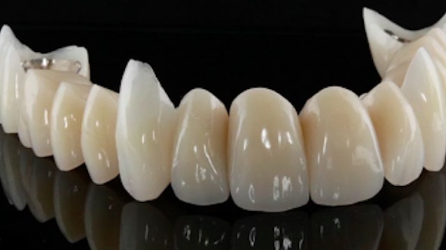 High End Implant Solutions for Patients with an Angle Class II Downhill Dentiti
