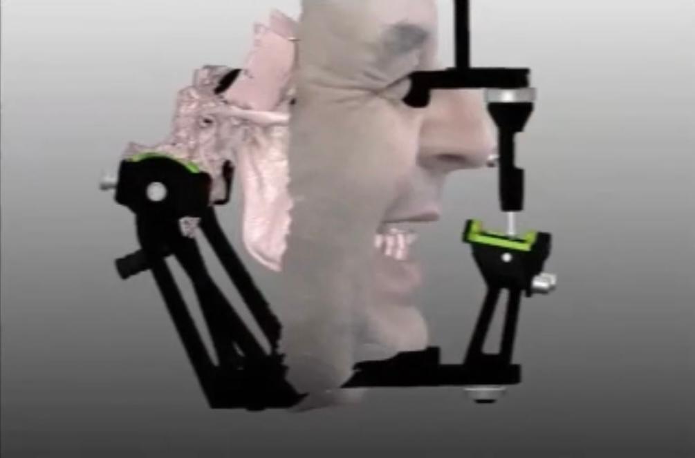 Treatment Planning in the Digital Era - Digital Patient Concept