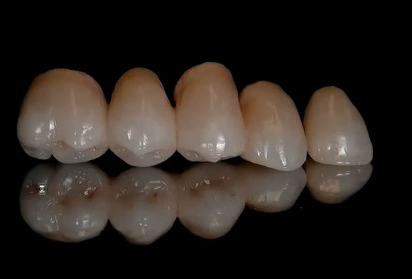 Insurance Coding and Inter-office Systems to Enhance Communication Between the