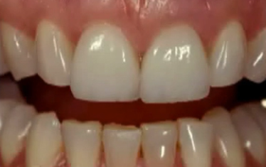 Biomimetic Restorative Dentistry (JAPANESE LANGUAGE)