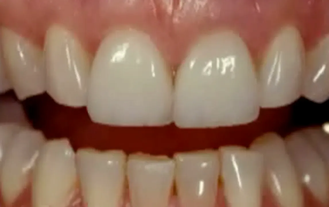 Biomimetic Restorative Dentistry (JAPANESE LANGUAGE) - gIDE Dental ...