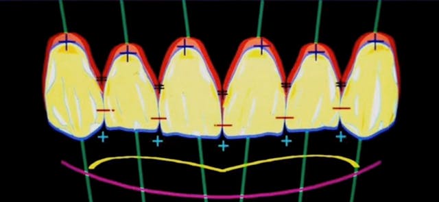 Smile Design