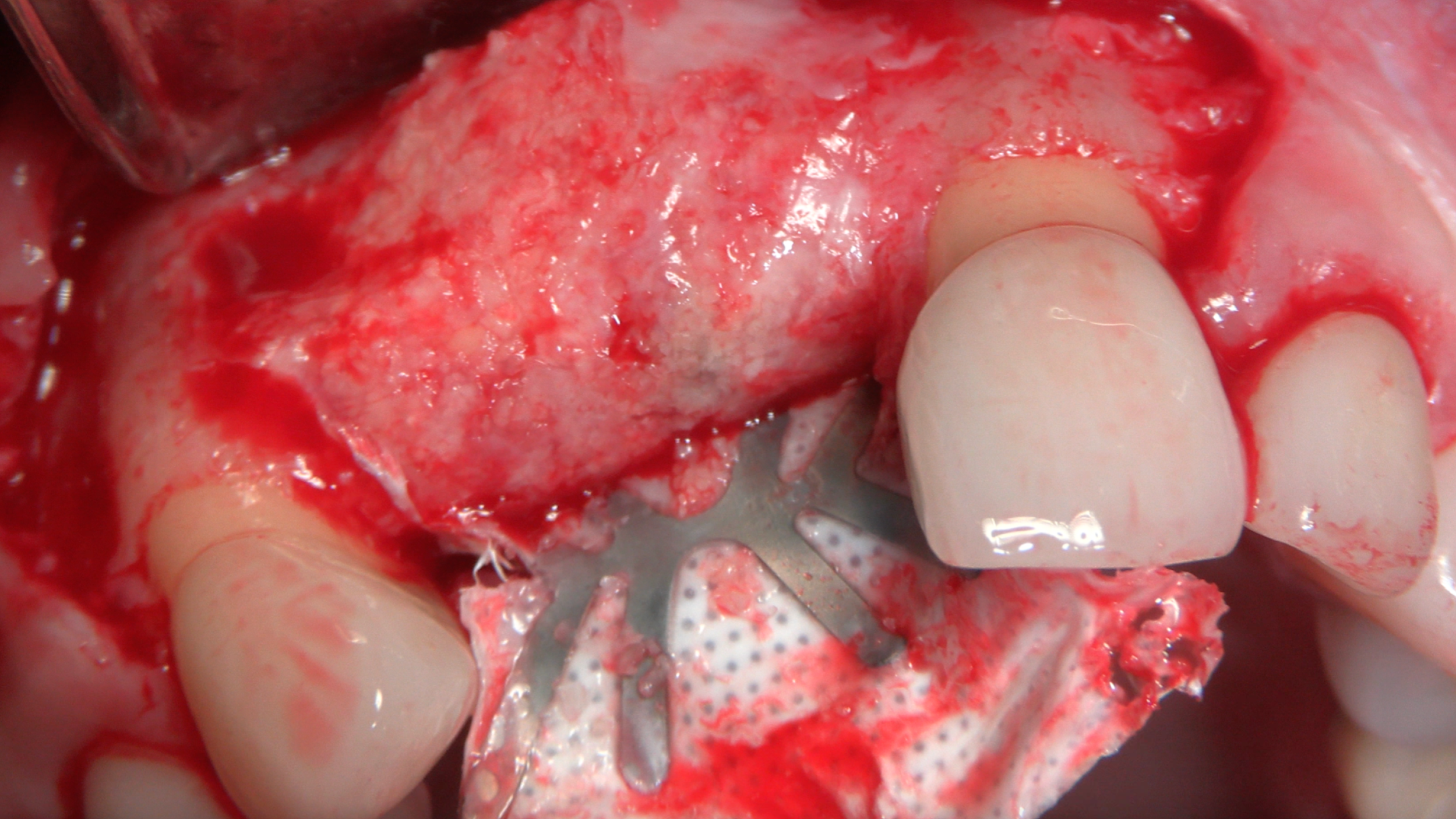 gIDE Dental Institute Video