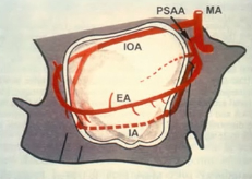 Sinus augmentation using the osteotome and lateral window technique with implan