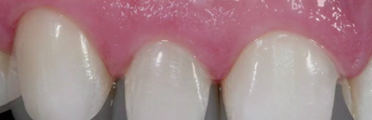 Adhesive & Esthetic Dentistry Minimally Invasive Procedures 04 Dr