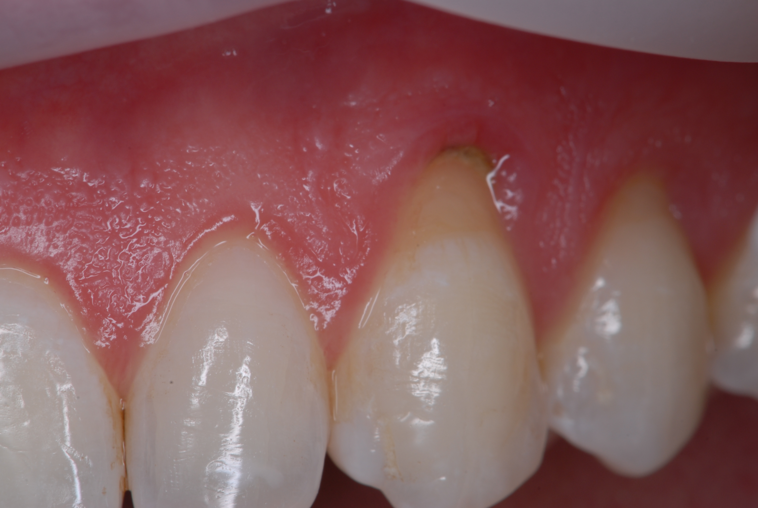 gIDE Dental Institute Video