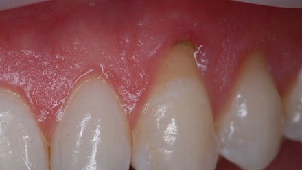 gIDE Dental Institute Video