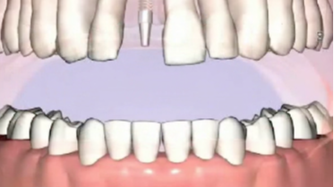 How to successfully evaluate and present cases, including determining fees; A p