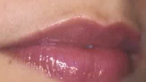 Current trends in Aesthetic Periodontology