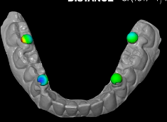Advantages of new digital technologies in prosthetic dentistry