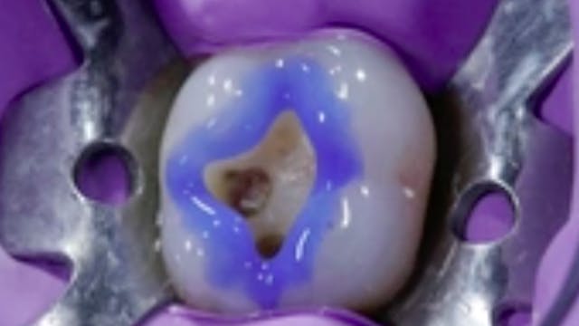 Adhesive & Esthetic Dentistry - Minim...