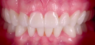 New Paradigms in Digital Dentistry: Digital Patient Concept | Dr F. Mintrone