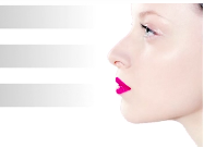 Predictability of the Extraction Site Implant Part 1: Do We Need a Buccal Plate