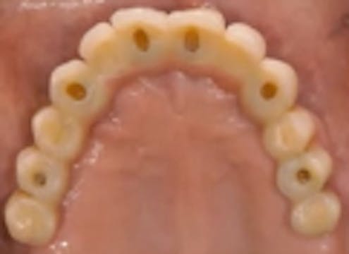 Biological Data for Bone Integration