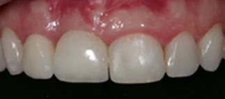 Soft Tissue Esthetics & Health – 10 Key Factors  | Dr S. Jovanovic