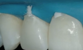 LIVE OFFICE HOURS and Q&A with Mintrone & Fabbri 