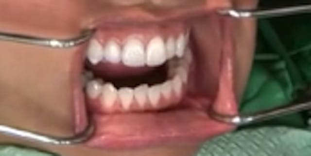 CLINICAL VIDEO Dental Photography: Ta...