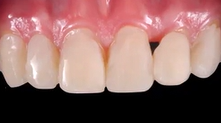 The Role of Orthodontist - Dr Fabbri Minimally Invasive Dentistry Dr Mintrone