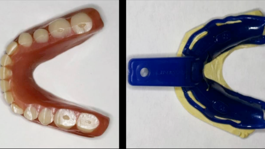 CAD/CAM Fabricated Complete Dentures: From Concept to Reality