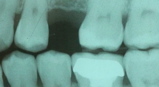 CLINICAL VIDEO Patient interview, treatment planning and laboratory phase for No