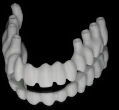 Treatment of Complications in Sinus G...