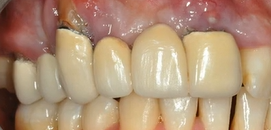 GBR Guidelines | Dr Marco Ronda