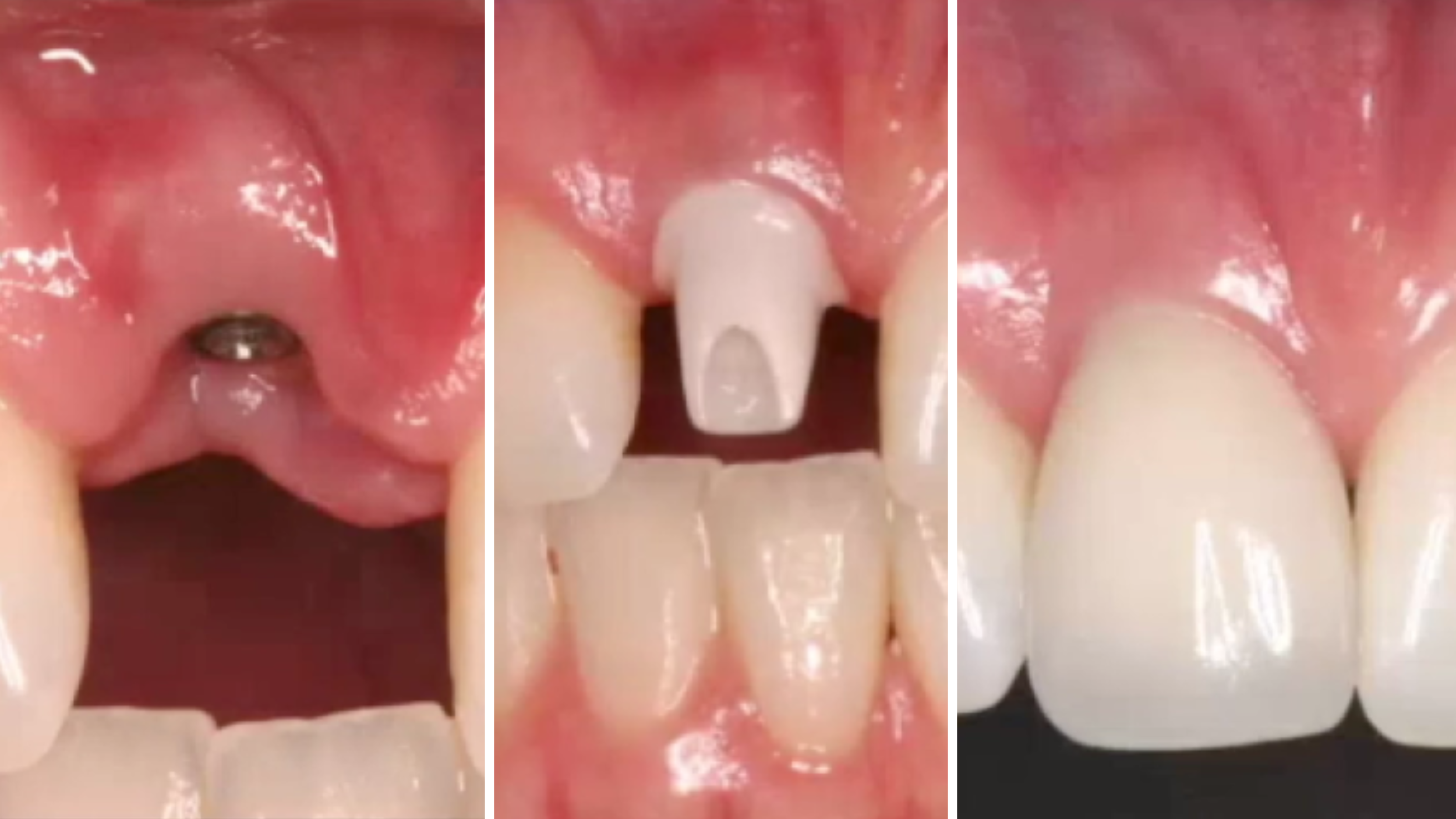 gIDE Dental Institute Video