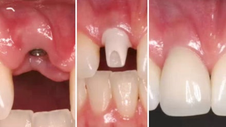 gIDE Dental Institute Video