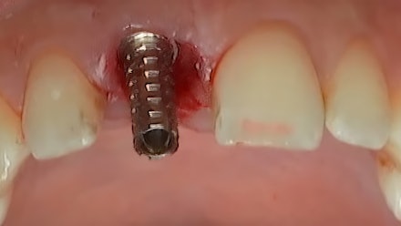 gIDE Dental Institute Video