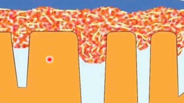 Adhesive Dentistry