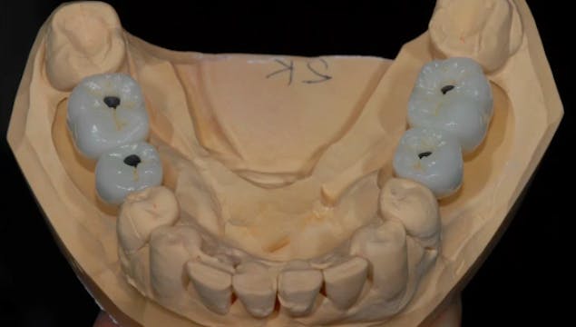 A-Z in Restorative Implant Dentistry ...