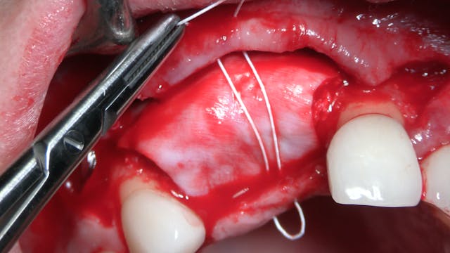 Passive Flap Closure with Horizontal ...