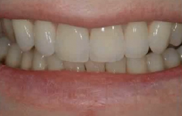 Non-Surgical Periodontal Therapy 01 | Ms Karima Bapoo-Mohamed