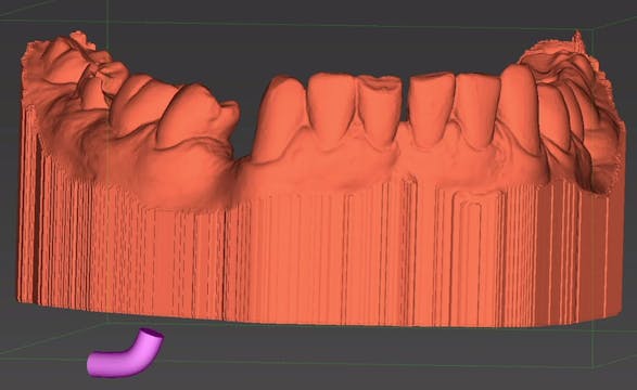 CLINICAL VIDEO How to make models in CDX