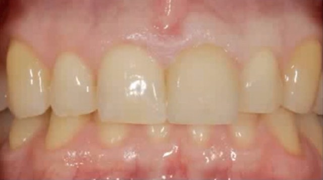Integrating "Esthetic" Dentistry and Prosthodontics