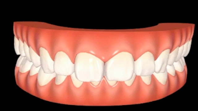 Minimally Invasive Aesthetic Dentistry & Invisalign