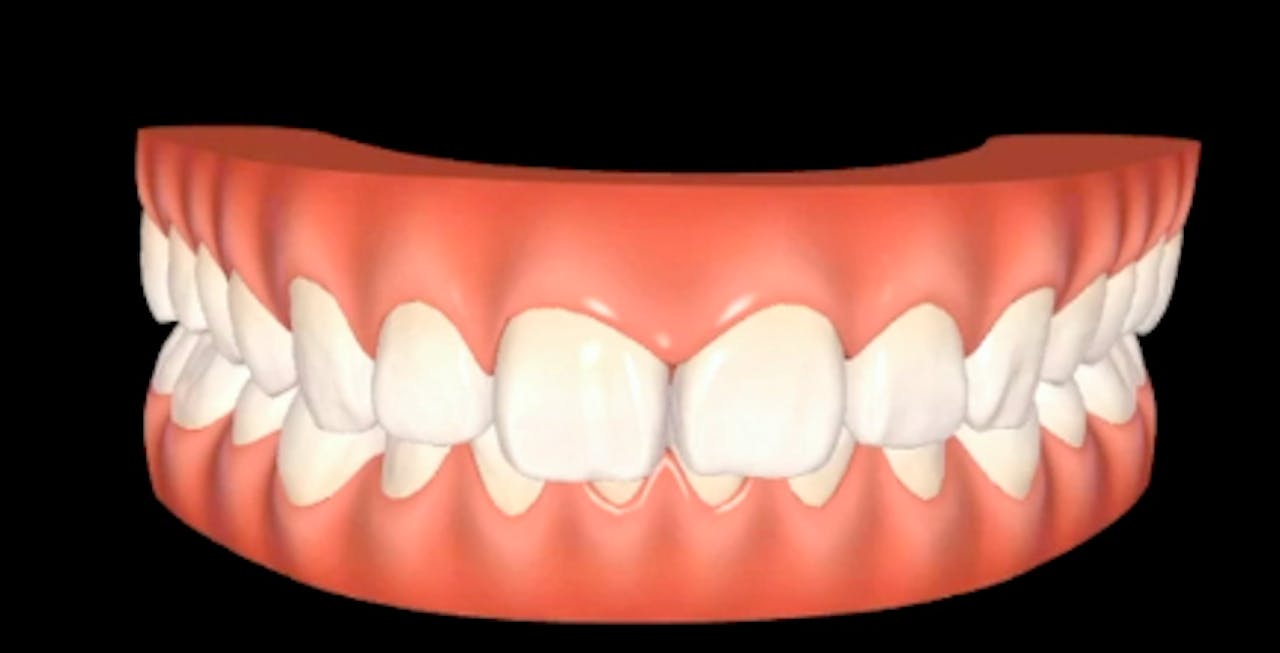 Minimally Invasive Aesthetic Dentistry & Invisalign gIDE Dental Institute