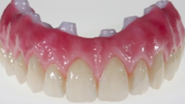 Complete Zirconia Restorations - Implant Supported