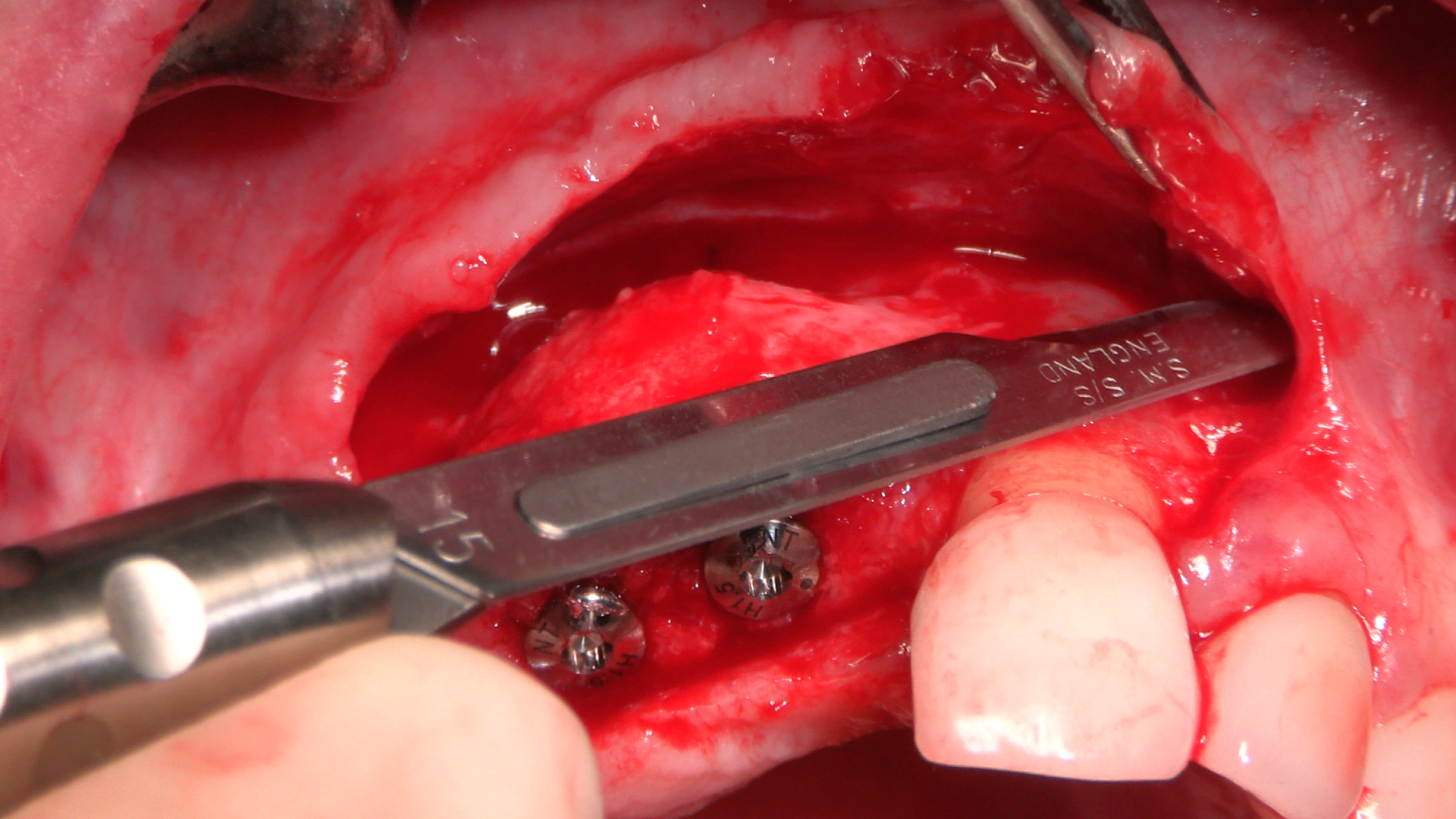 gIDE Dental Institute Video