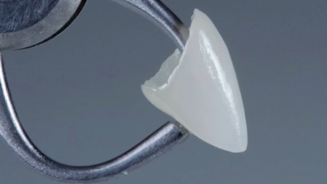 Adhesive & Esthetic Dentistry - Minimally Invasive Procedures (Part 4 of 4)