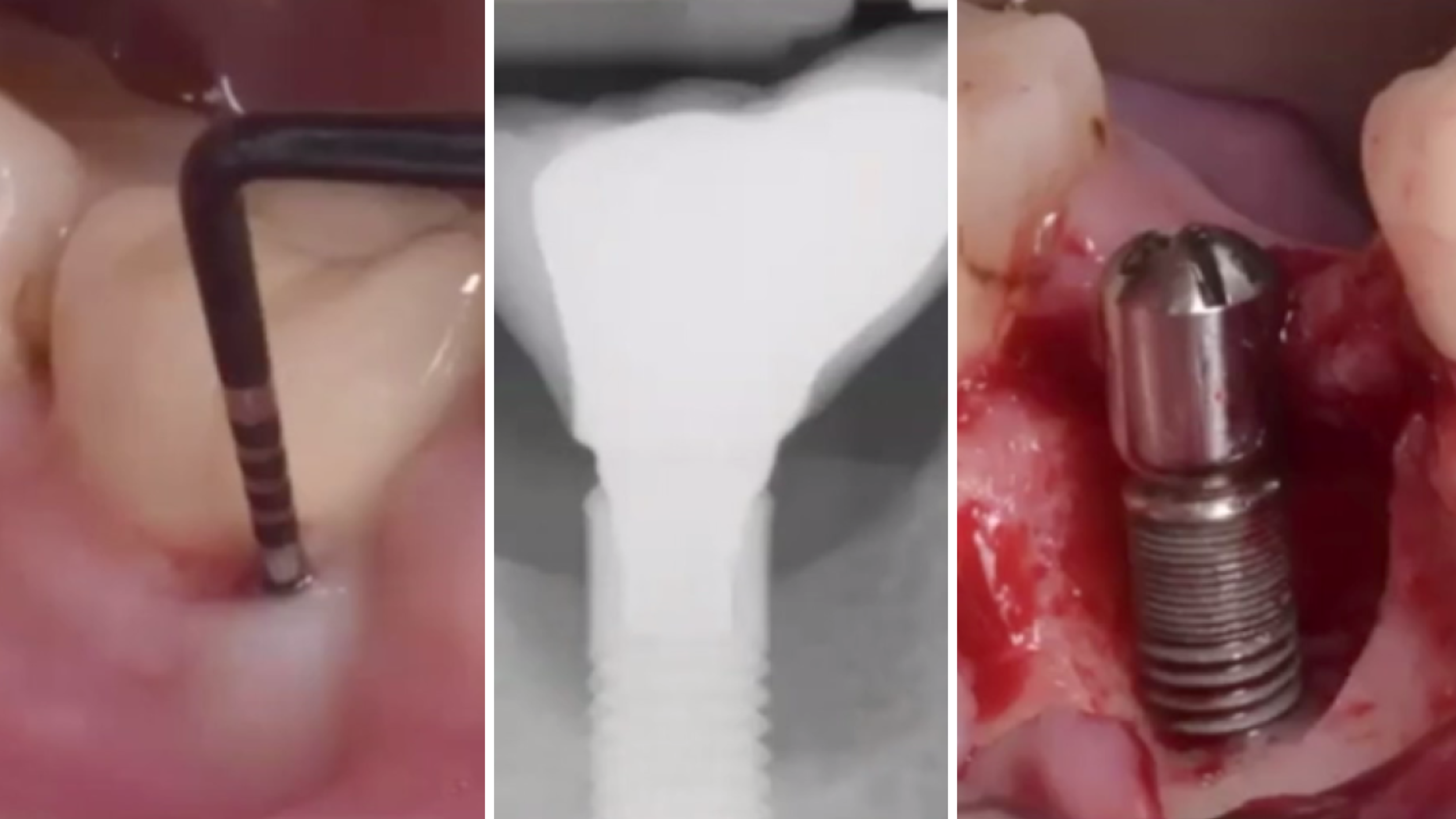 gIDE Dental Institute Video