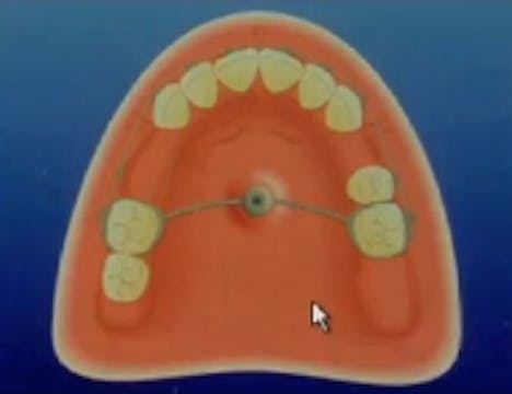 Implant Interactions in Orthodontics