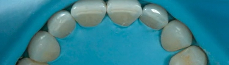 Minimally Invasive Aesthetic Dentistry & Invisalign | Dr Monik Vasant