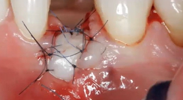 LIVE TREATMENT PLANNING SESSION and Q&A | Dr Sascha A Jovanovic 