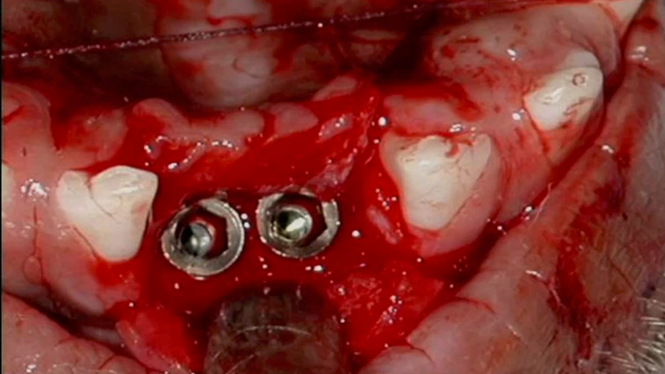 Implant Complications: Prevention, Correction and Maintenance