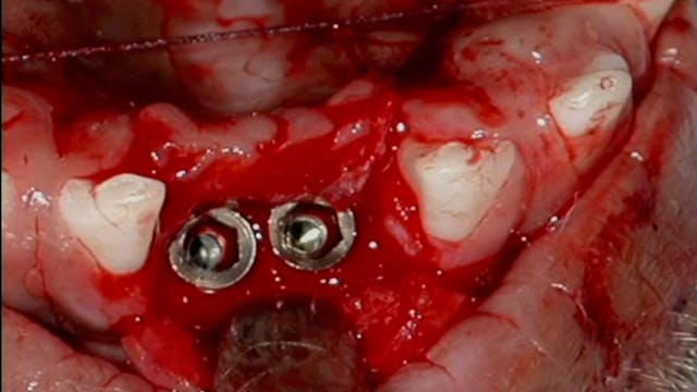 Implant Complications: Prevention, Co...