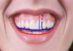 The Art of The Smile-From Diagnosis to Individualized Multidisciplinary Treatme