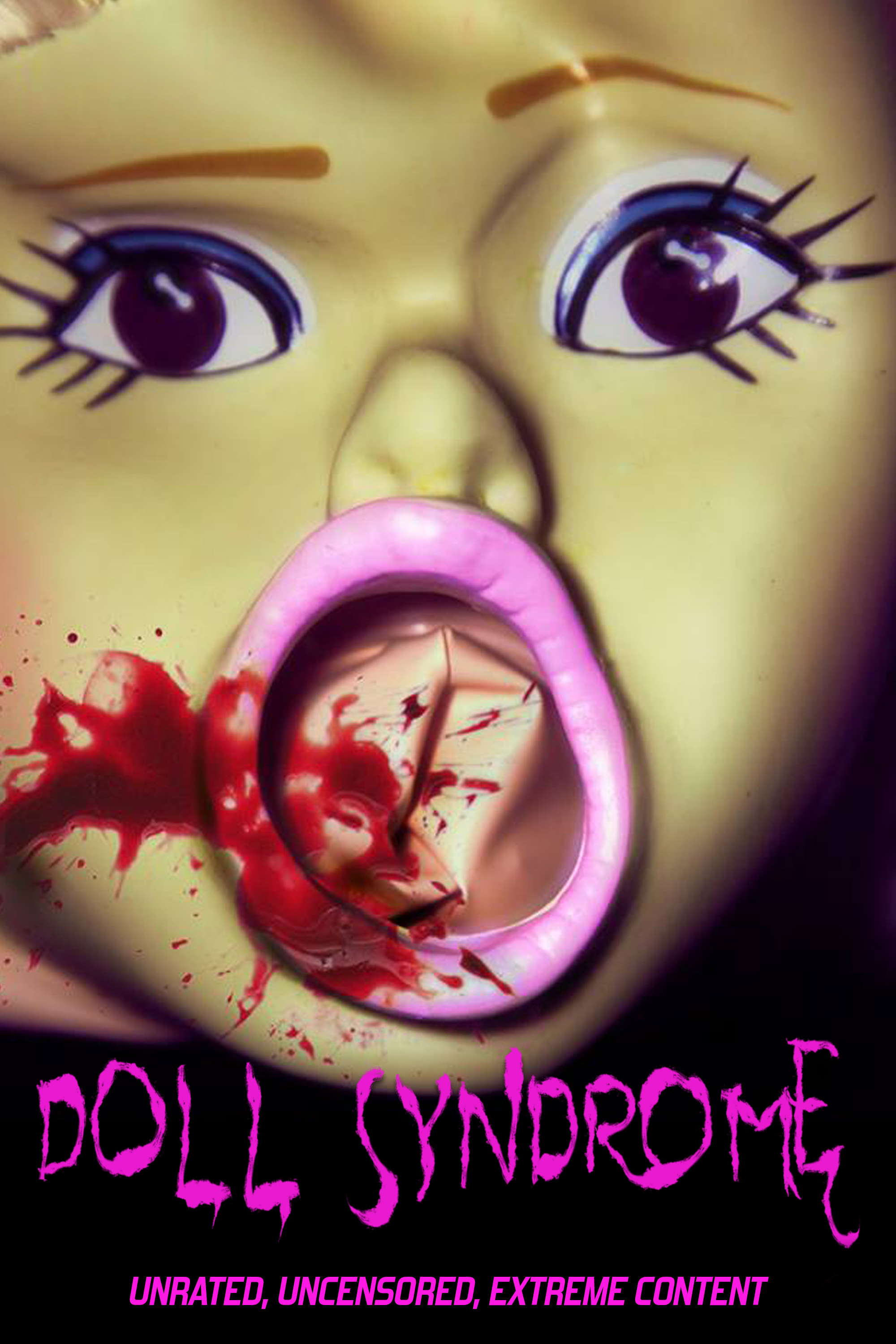 Doll Syndrome